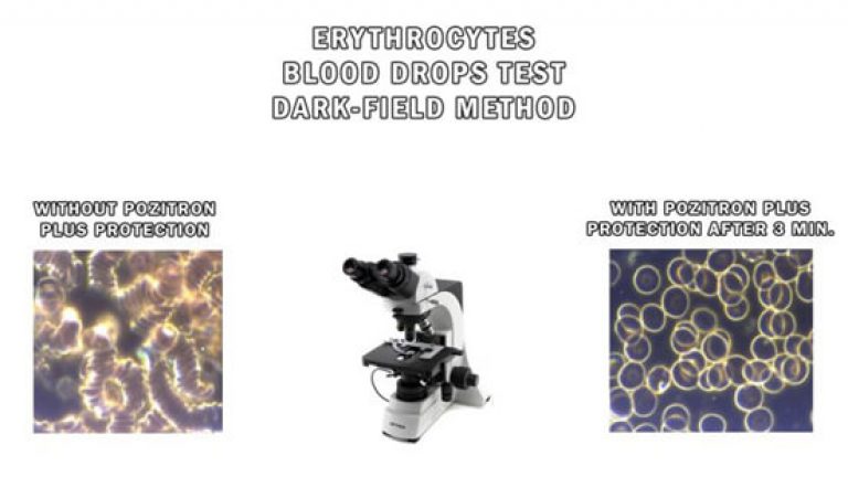 Darkfield-Method-Blood-Drops-Test-768x432